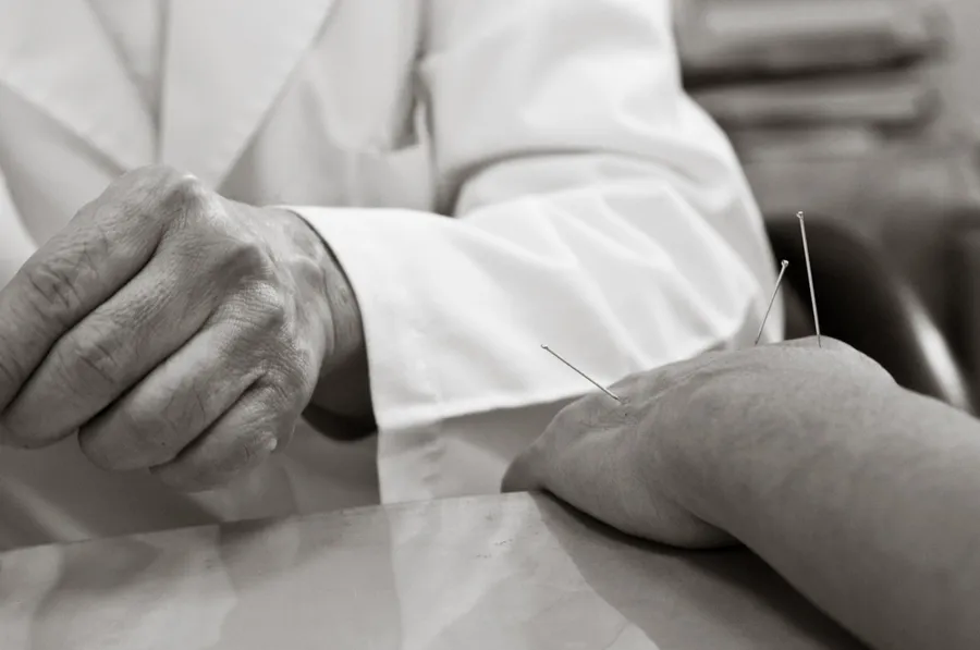 英、美科學家證實，針灸不僅有止痛效果還能治療憂鬱症