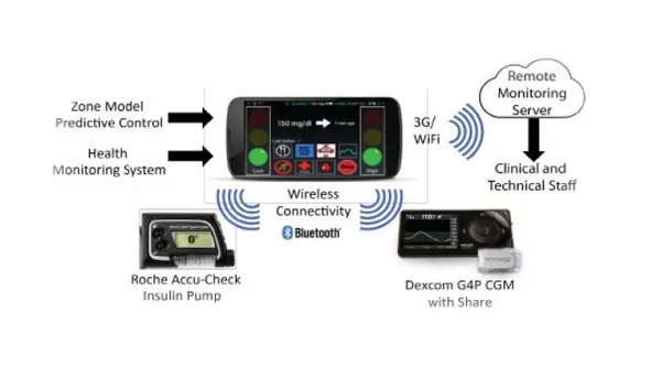 Artificial pancreas