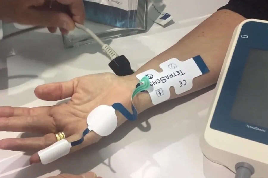 精準麻醉！非侵入式 TetraGraph 監視手術患者麻醉程度避免不當醫療風險