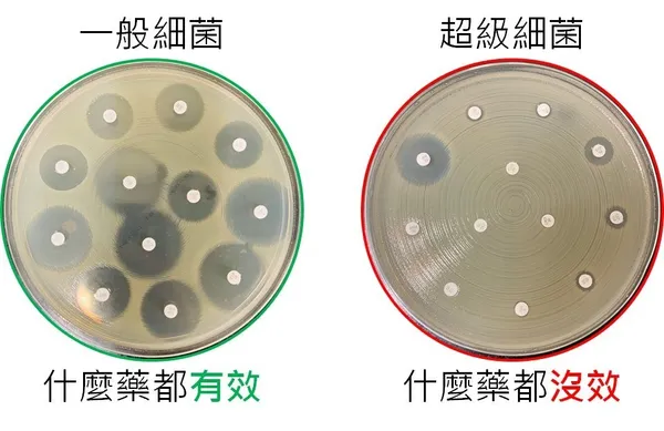 超級細菌