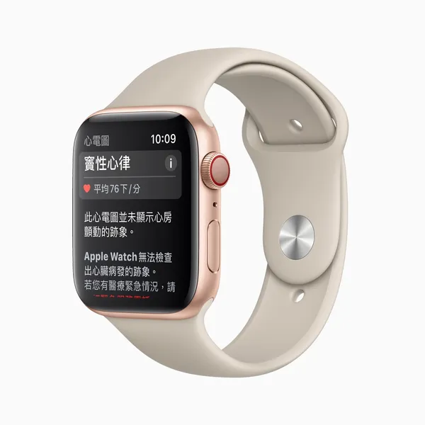 Apple-watch-result-sinusrhythm-screen_12082020_inl