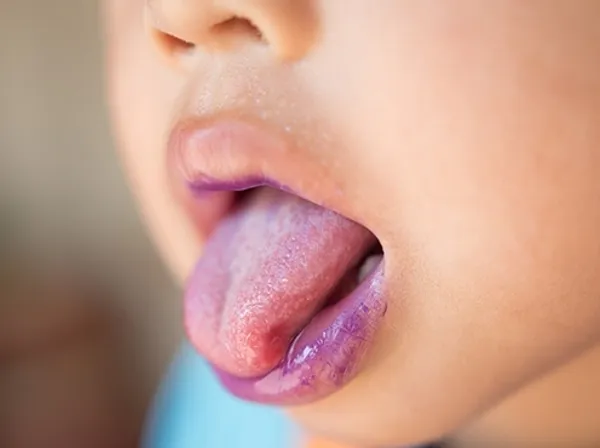 腸病毒