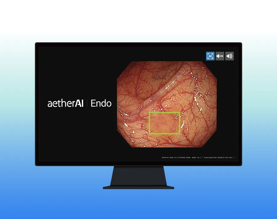 AI偵測大腸瘜肉準確率95%，雲象攜手台大、國泰開發智慧醫材打國際盃