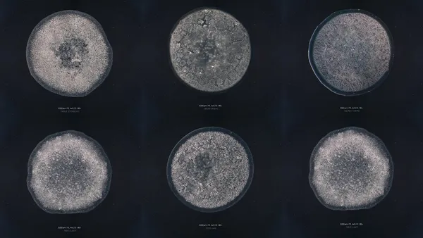 淚水的形狀像小行星！荷蘭攝影師以《淚之想像》系列作品，分享不同情緒的眼淚結晶