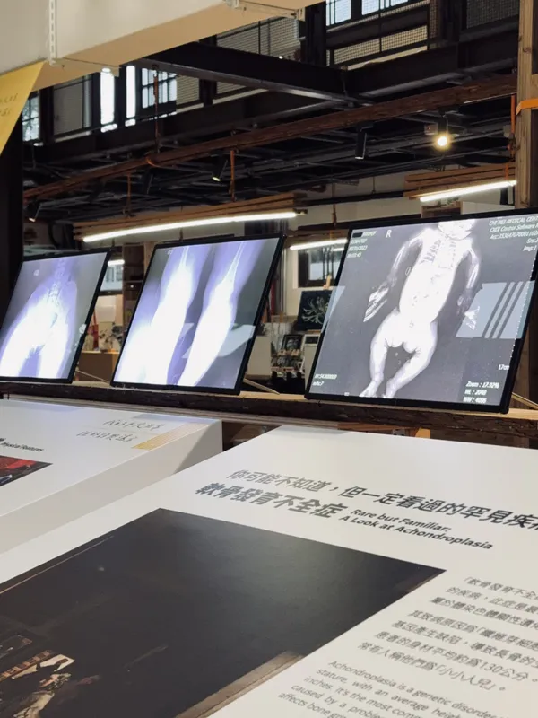 瓶蓋工廠罕病特展