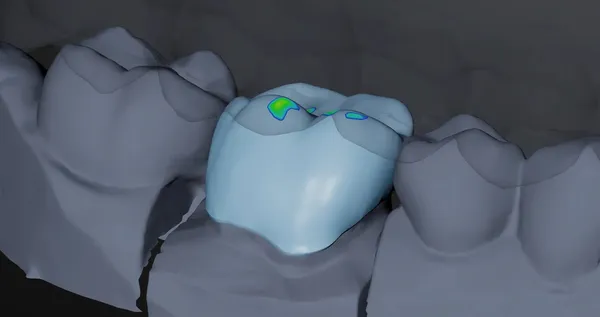 Dentscape