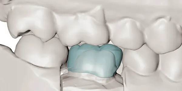 Dentscape