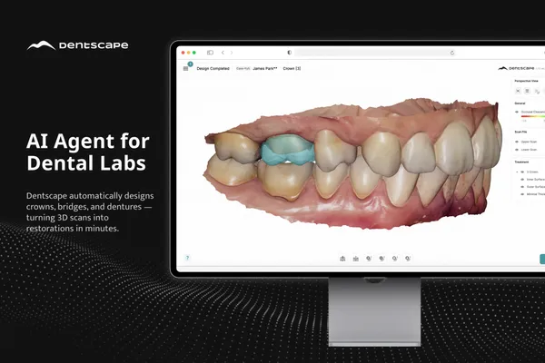 Dentscape