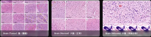PaTHOScope 影像畫面
