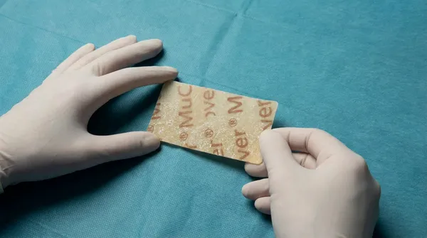聚動分子產品MuCover® Oral Wound Dressing